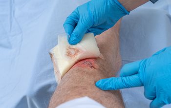 Wound Care